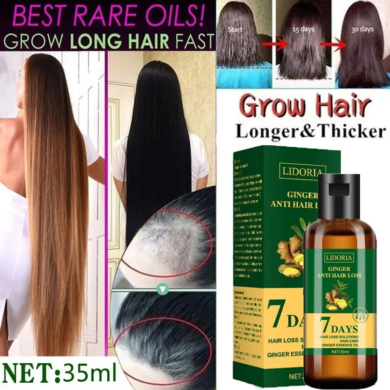 Ingwer Haarwuchs ätherisches Ö – Hair Care Essential Oil Atomizing Bewertung und Preis