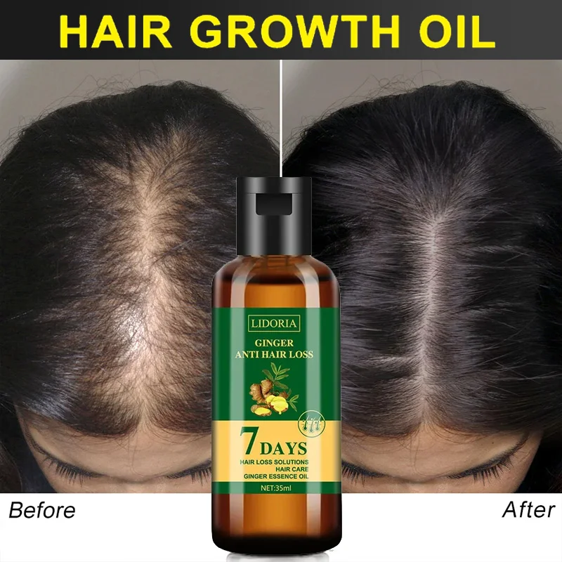 Ingwer Haarwuchs ätherisches Ö – Hair Care Essential Oil Atomizing Bewertung und Preis