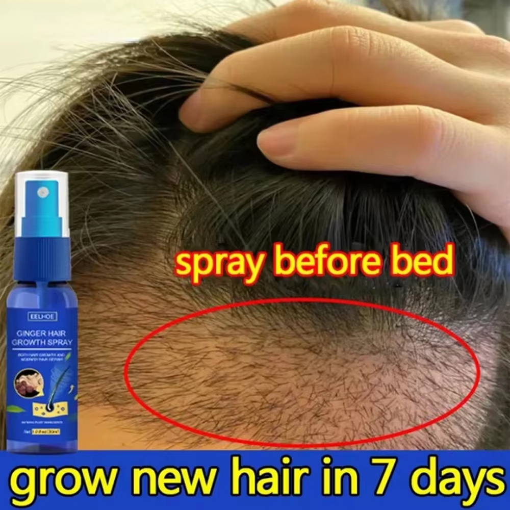 Schnelles Ingwer-Haarwuchsspra – Hair Care Natural Bewertung und Preis
