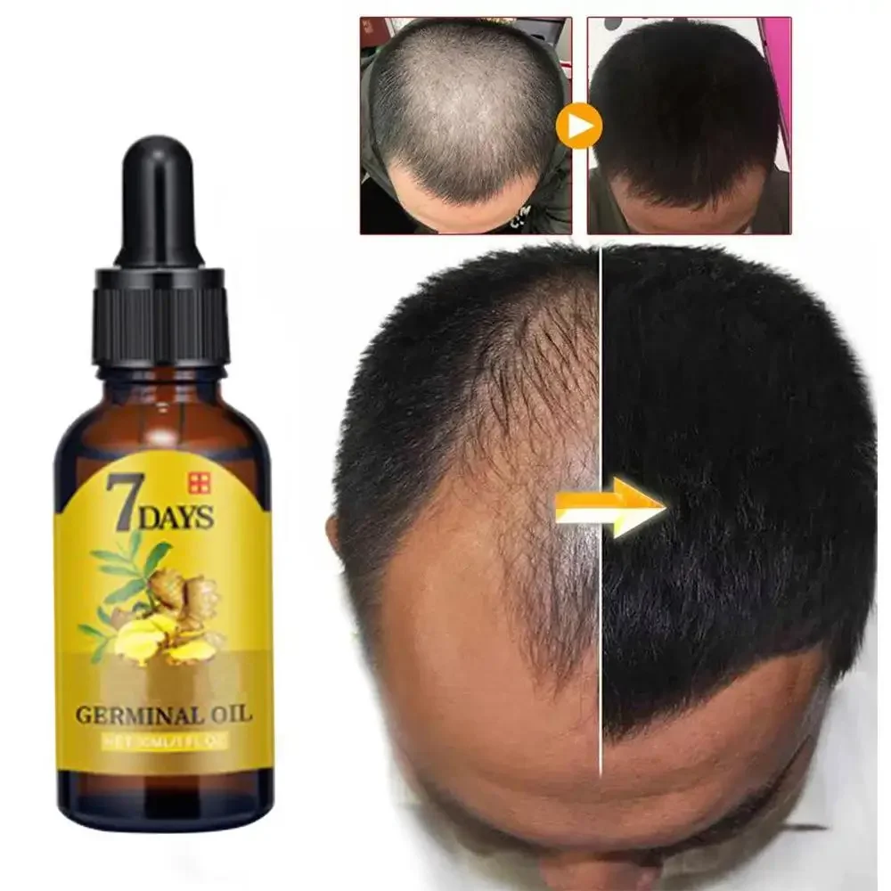 Haarwachstums-Ingwer, schnell  – Hair Care Essential Oil Atomizing Bewertung und Preis